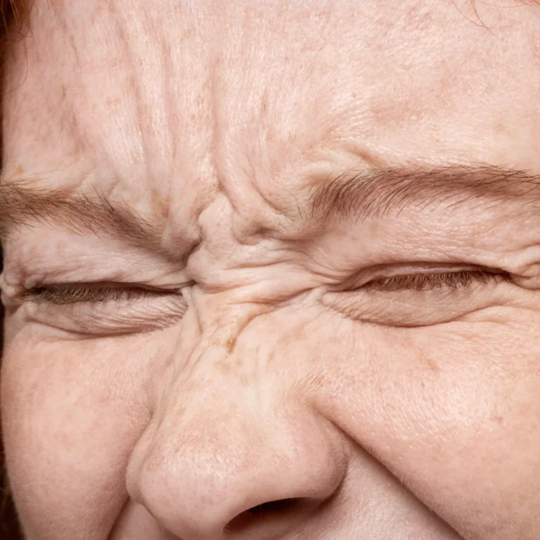 alejandra-vago-toxina-butolinica