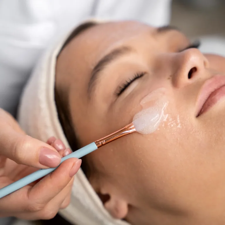 peeling-facial-tratamiento